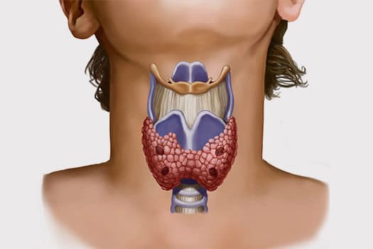 расположение щитовидной железы на теле