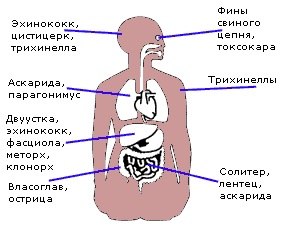 рисунок тела человека с обозначением мест где могут быть паразиты